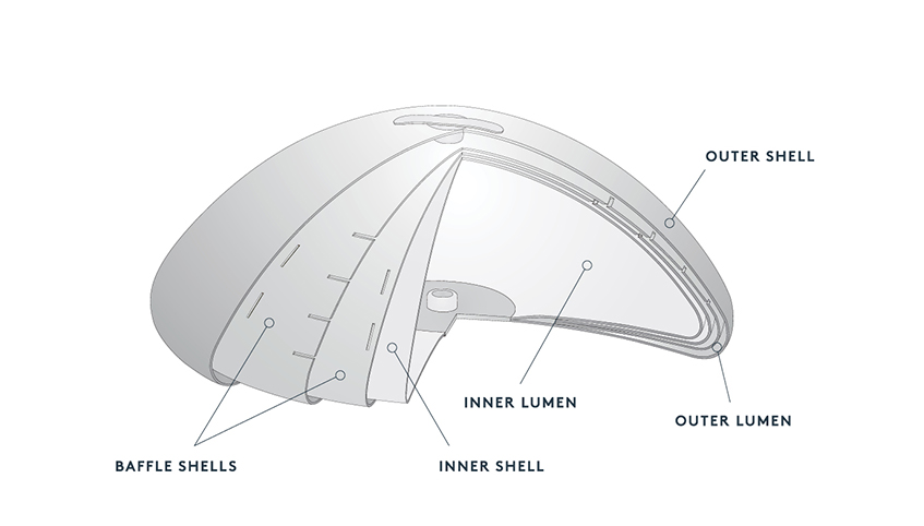 Ideal implant model
