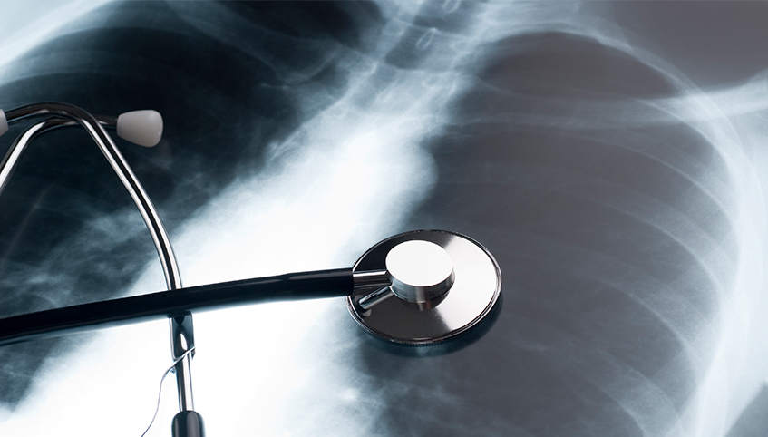 Stethoscope lying on top of chest x-ray.