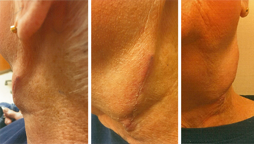 Pre-Arteriogram Instructions | The University of Kansas Health System Pre-Arteriogram Instructions | The University of Kansas Health System