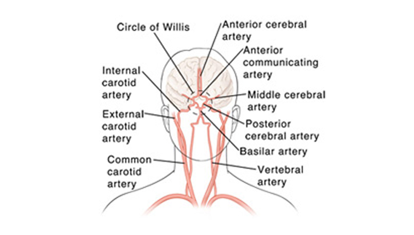 Head and neck arteries graphic