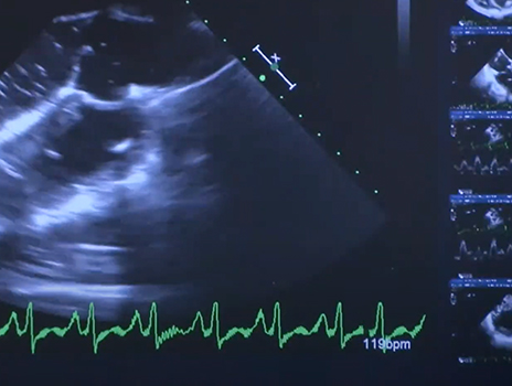 Image of an ultrasound