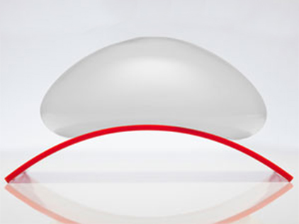 Ideal implant curve