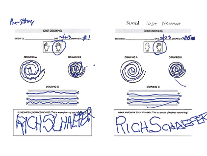 Exablate spiral diagram