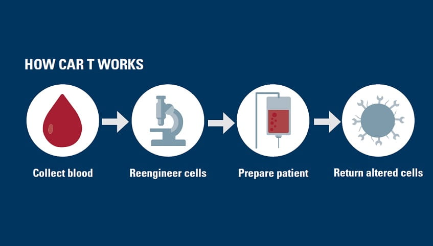 How CAR T works: blood is collected, cells are reengineered, the patient is prepared and then the altered cells are returned to the patient