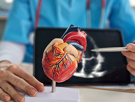 Model of a heart