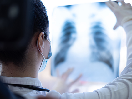 Doctor examining chest imaging