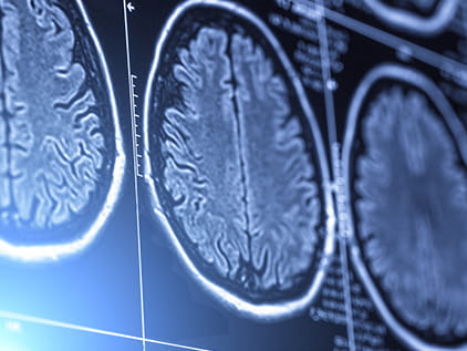 How does the Brain Health Care Accelerator work? How does the Brain Health Care Accelerator work?